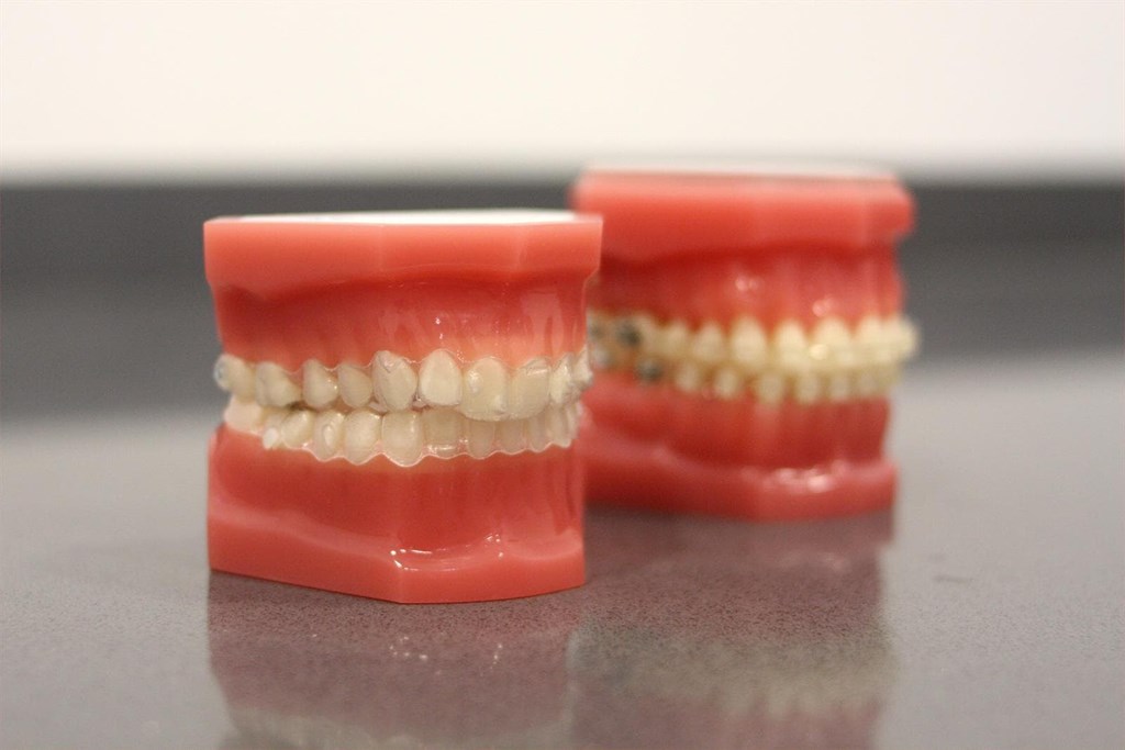 Clínica Ferro: el cuánto, el cómo y el cuándo del cepillado dental