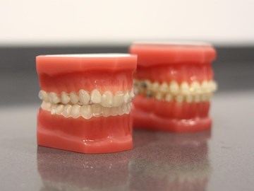 Clínica Ferro: el cuánto, el cómo y el cuándo del cepillado dental