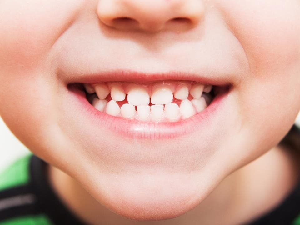 ¿Cómo saber si mi hijo tiene caries?