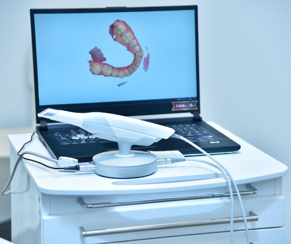 Escáner intraoral: qué es y qué ventajas tiene para la salud bucodental