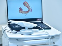 Escáner intraoral: qué es y qué ventajas tiene para la salud bucodental