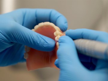 Prótesis dentales: qué aportan y cuáles existen 